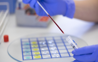 © Österreichisches Rotes Kreuz (ÖRK)/Helmut Mitter Im Labor wird das bei einer Blutspende abgenommene Blut untersucht. Ein Teil des Blutes wird in einer Pipette gezeigt.